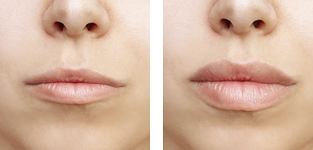 labios-ejemplo