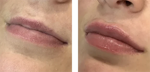 labios